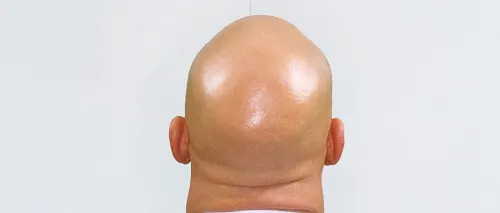 jeffbezosforeskin