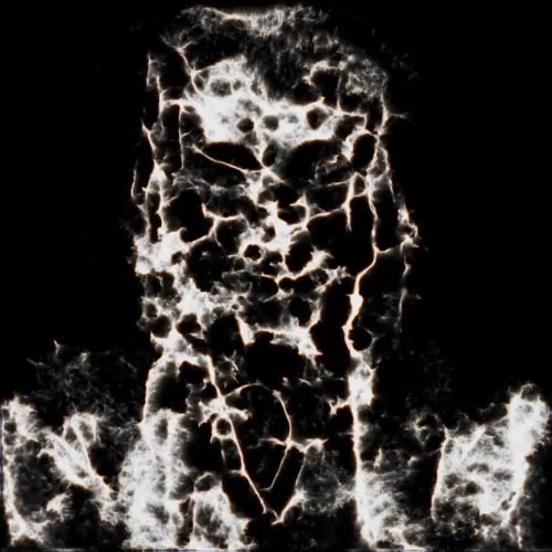 Aura Migraine