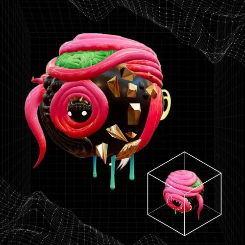 Teratoma 3D