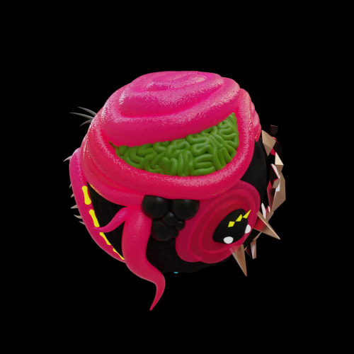 Teratoma